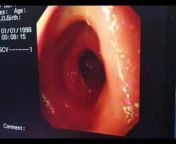 #digestive endoscopy.دكتور سالم يوسف