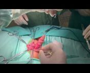 Dr. Togrul Omarov Surgery