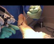 The American Society of Podiatric Surgeons (ASPS)