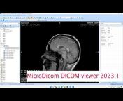 MicroDicom DICOM Viewer