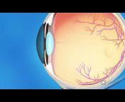 EyeSmart — American Academy of Ophthalmology