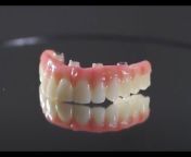 JAX Implants u0026 Dentures