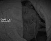 This is the trailer for GRAYSON, a mini-documentary shot in August of 2014. GRAYSON is a story of loss, love and perseverance. It’s the story of a child taken from this world far too soon, of parents who loved him beyond measure for every second of his life and every second since, and a nurse who stayed by their side throughout it all. It is a story about extraordinary human beings, from the tiniest and most fragile of us all to those with the biggest hearts and greatest capacity for love and