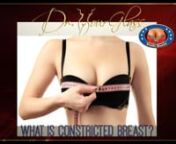 Hi, this is Dr. Hourglass, and welcome to another video in our channel Wonder Breasts. Today we are going to discuss: What is constricted breast?In this channel we discuss everything related to breast surgery.nnWelcome back!Breasts exist in different shapes and sizes. Constricted breasts are shaped in a way that makes the patients think their breasts are abnormally different than the breasts of other women. The condition is also found in men; however, men are relatively less sensitive abou