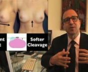 There is a condition called &#39;bird chest&#39; or pectus carinatum, which means that your chest wall is raised at the center. If you are considering breast enlargement, the type of breast implant you choose is important. Watch my video to find out which implant style I recommend for this type of hollow chest.