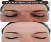 Note: 100% Satisfaction, 60-Day Money-Back Guarantee. ✨ Unveil the secret to ageless beauty! ✨ Say goodbye to wrinkles with the revolutionary &#92;