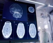 Global Increase of , Neurological Disorders , &#39;Very Concerning,&#39; Researchers Say.&#60;br/&#62;&#39;Newsweek&#39; reports that a new study &#60;br/&#62;warns that neurological disorders have &#60;br/&#62;become more common worldwide.&#60;br/&#62;According to a team of international researchers, &#60;br/&#62;the number of people with such conditions has &#60;br/&#62;risen &#92;