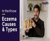Unlock the secrets of eczema with Dermatologist Dr. Usama Syed in this informative video. Learn about the various triggers, types, and treatment options for eczema, a condition affecting over 230 million people worldwide. Dr. Sayed delves into the layers of the skin, explores different eczema patterns, and offers valuable insights on choosing the right moisturizer to reinforce the skin barrier. Whether you&#39;re familiar with eczema or seeking essential skincare knowledge, this episode of &#92;