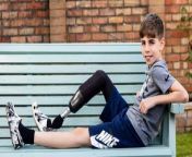 A little boy who lost his foot at 18 months has become a model and now he travels the world posing for famous brands including Primark, Amazon and Schuh. &#60;br/&#62;&#60;br/&#62;Arlo Tate, nine, was diagnosed with fibular hemimelia - a missing fibula - at birth. &#60;br/&#62;&#60;br/&#62;An &#92;
